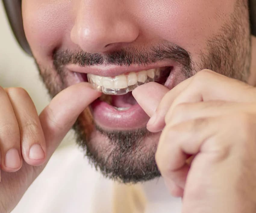 Retainers package
