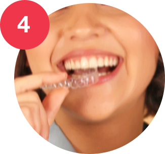 Receive your invisible braces