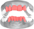 teeth crowding visual representation with circles