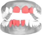 teeth spacing visual representation with circles